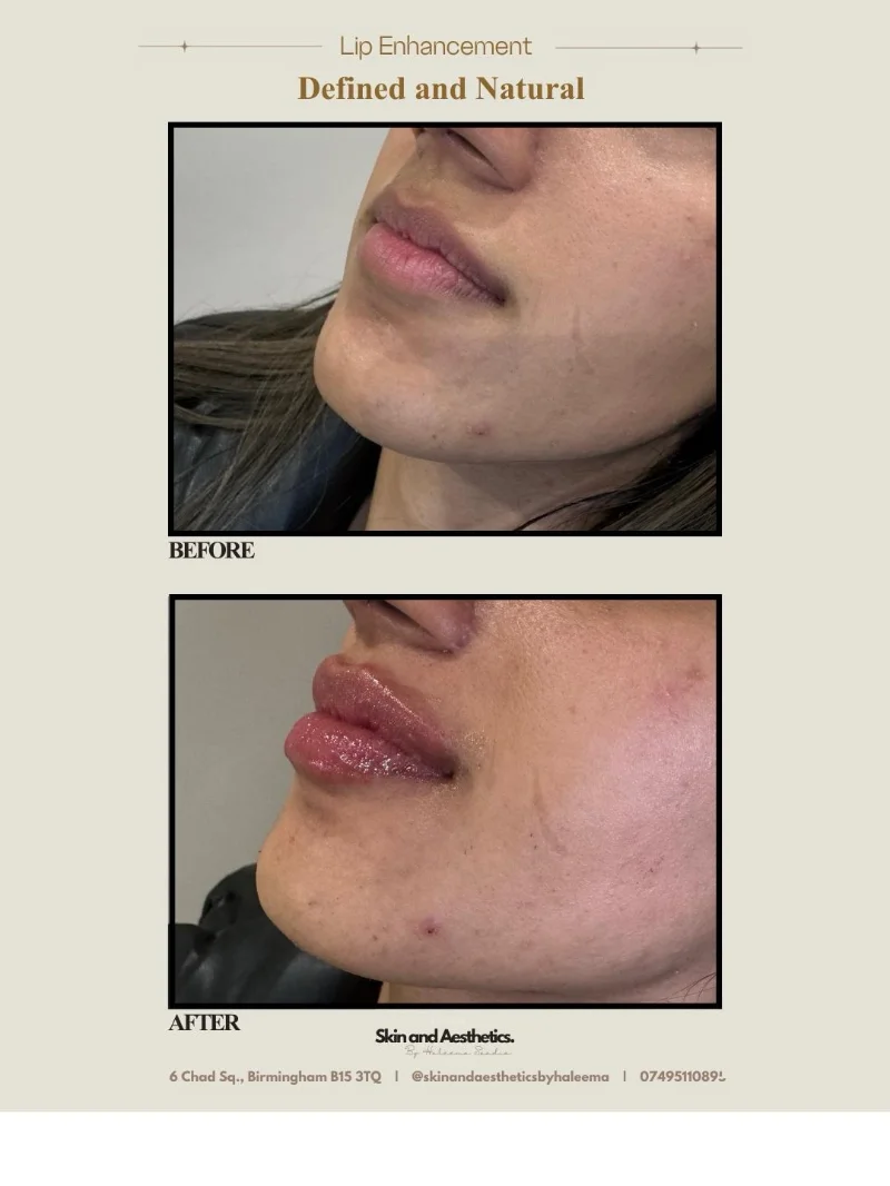 Beauty treatment result